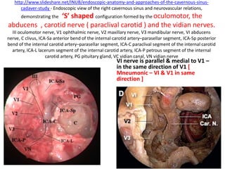 The lower dural ring is given by the COM [ Carotid-oculomotor
membrane ] , that lines the inferior surface of the ACP. It can be visible, through a
transcranial route, only by removing the ACP. The lower dural ring is also called
Perneczky’s ring. Medially the COM blends with the dura that lines the carotid sulcus
(Yasuda et al. 2005 )
Endoscopic supraorbital view with a 30°
down-facing lens -The right portion of the
planum sphenoidale is seen from above.
Right side
 