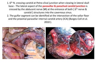 The TC [ tentorium cerebelli ], with the trochlear nerve inside,
can be visualized passing inferiorly to the IIIcn.
endoscopic transclival view
 