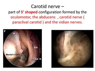 1. In the posterior part of the CS the trochlear nerve is below the oculomotor nerve,
while anteriorly it turns upward and becomes the most superior structure of the CS
(at the level of the optic strut) (Iaconetta et al. 2012 ) .
2. Trochlear nerve is always
superior to V1.
 