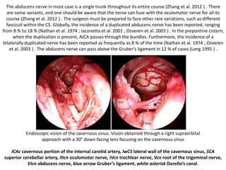 Supra-trochlear triangle Infra-trochlear triangle
 
