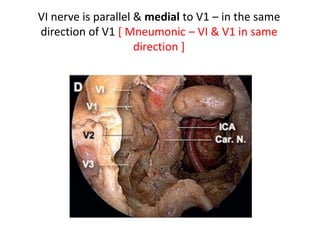http://www.slideshare.net/INUB/endoscopic-anatomy-and-approaches-of-the-cavernous-
sinus-cadaver-study -Endoscopic view of the right cavernous sinus showing its neurovascular
relations and the main anatomic areas. III oculomotor nerve, V1 ophthalmic nerve, V2
maxillary nerve, V3 mandibular nerve, VI abducens nerve, C clivus, ICA-Sa anterior bend of
the internal carotid artery–parasellar segment, ICA Sp posterior bend of the internal carotid
artery–parasellar segment, ICA-C paraclival segment of the internal carotid artery, ICA-L
lacerum segment of the internal carotid artery, ICA-P petrous segment of the internal carotid
artery, PG pituitary gland, VC vidian canal, VN vidian nerve, STA superior triangular area, SQA
superior quadrangular area, IQA inferior quadrangular area
1.Supra Trochanteric & Infratrochanteric Triangles
2. Upper & lower dural rings
 