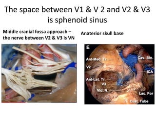 http://www.slideshare.net/INUB/endoscopic-anatomy-and-approaches-of-the-cavernous-sinus-
cadaver-study - Endoscopic view of the right cavernous sinus and neurovascular relations,
demonstrating the ‘S’ shaped configuration formed by the oculomotor, the
abducens , carotid nerve ( paraclival carotid ) and the vidian nerves.
III oculomotor nerve, V1 ophthalmic nerve, V2 maxillary nerve, V3 mandibular nerve, VI abducens
nerve, C clivus, ICA-Sa anterior bend of the internal carotid artery–parasellar segment, ICA-Sp posterior
bend of the internal carotid artery–parasellar segment, ICA-C paraclival segment of the internal carotid
artery, ICA-L lacerum segment of the internal carotid artery, ICA-P petrous segment of the internal
carotid artery, PG pituitary gland, VC vidian canal, VN vidian nerve
VI nerve is parallel & medial to V1 –
in the same direction of V1 [
Mneumonic – VI & V1 in same
direction ]
 
