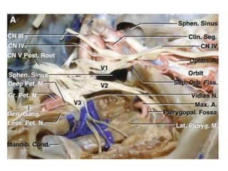 Meningo-hypophyseal trunk & carotid nerve
 