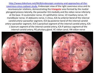 1. 6th N. crossing carotid at Petro-clival junction when viewing in lateral skull base - The
lateral aspect of the parasellar & paraclival carotid junction is crossed by the
abducent nerve (VI) at the entrance of both [ 6th nerve & carotid ] structures into the
cavernous sinus.
2. The gulfar segment can be identified at the intersection of the sellar floor and the
proximal parasellar internal carotid artery (ICA) (Barges-Coll et al. 2010 ).
 