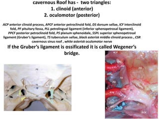 cavernous Roof has - two triangles:
1. clinoid (anterior)
2. oculomotor (posterior)
ACP anterior clinoid process, APCF anterior petroclinoid fold, DS dorsum sellae, ICF interclinoid
fold, PF pituitary fossa, PLL petrolingual ligament (inferior sphenopetrosal ligament),
PPCF posterior petroclinoid fold, PS planum sphenoidale, SSPL superior sphenopetrosal
ligament (Gruber’s ligament), TS tuberculum sellae, black asterisk middle clinoid process , CSR
cavernous sinus roof , white asterisk oculomotor nerve
If the Gruber’s ligament is ossificated it is called Wegener’s
bridge.
 