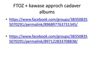1. In the posterior part of the CS the trochlear nerve is below the oculomotor nerve, while
anteriorly it turns upward and becomes the most superior structure of the CS (at the level of
the optic strut) (Iaconetta et al. 2012 ) .
2. Trochlear nerve is always superior to V1.
 