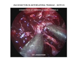 JNA DISSECTION IN ANTEROLATERAL TRIANGLE .. NOTE V3
 