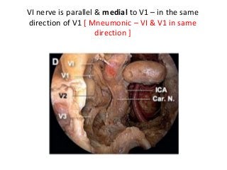VI nerve is parallel & medial to V1 – in the same
direction of V1 [ Mneumonic – VI & V1 in same
direction ]
 