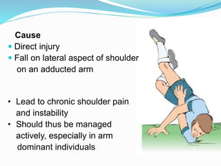Fall Onto R Shoulder Anotomic-Biological Reconstruction of Acromio-Clavicular Joint Injuries ...