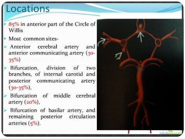 vascular brain lesions for radiology by dr soumitra halder
