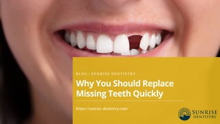 Why You Should Replace
Missing Teeth Quickly
B L O G | S U N R I S E D E N T I S T R Y
https://sunrise-dentistry.com/
 