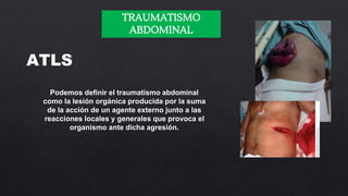 TRAUMATISMO
ABDOMINAL
ATLS
Podemos definir el traumatismo abdominal
como la lesión orgánica producida por la suma
de la ac...