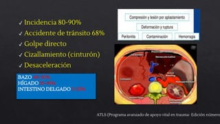 Ferrada, R., García, A., Cantillo, E., Aristizábal, G., Abella, H. Trauma de abdomen. Guías de práctica clínica basadas en...