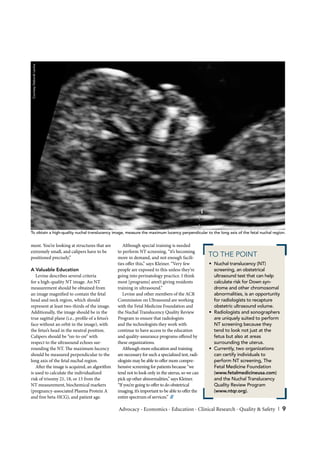 Courtesy Deborah Levine




To obtain a high-quality nuchal translucency image, measure the maximum lucency perpendicular to the long axis of the fetal nuchal region.


ment. You’re looking at structures that are         Although special training is needed
extremely small, and calipers have to be         to perform NT screening, “it’s becoming
positioned precisely.”                           more in demand, and not enough facili-
                                                                                                    TO THE POINT
                                                 ties o er this,” says Kleiner. “Very few           • Nuchal translucency (NT)
A Valuable Education                             people are exposed to this unless they’re            screening, an obstetrical
   Levine describes several criteria             going into perinatology practice. I think            ultrasound test that can help
for a high-quality NT image. An NT               most [programs] aren’t giving residents              calculate risk for Down syn-
measurement should be obtained from              training in ultrasound.”                             drome and other chromosomal
an image magni ed to contain the fetal              Levine and other members of the ACR               abnormalities, is an opportunity
head and neck region, which should               Commission on Ultrasound are working                 for radiologists to recapture
represent at least two-thirds of the image.      with the Fetal Medicine Foundation and               obstetric ultrasound volume.
Additionally, the image should be in the         the Nuchal Translucency Quality Review             • Radiologists and sonographers
true sagittal plane (i.e., pro le of a fetus’s   Program to ensure that radiologists                  are uniquely suited to perform
face without an orbit in the image), with        and the technologists they work with                 NT screening because they
the fetus’s head in the neutral position.        continue to have access to the education             tend to look not just at the
Calipers should be “on-to-on” with               and quality-assurance programs o ered by             fetus but also at areas
respect to the ultrasound echoes sur-            these organizations.                                 surrounding the uterus.
rounding the NT. e maximum lucency                  Although more education and training            • Currently, two organizations
should be measured perpendicular to the          are necessary for such a specialized test, radi-     can certify individuals to
long axis of the fetal nuchal region.            ologists may be able to o er more compre-            perform NT screening, The
   A er the image is acquired, an algorithm      hensive screening for patients because “we           Fetal Medicine Foundation
is used to calculate the individualized          tend not to look only in the uterus, so we can       (www.fetalmedicineusa.com)
risk of trisomy 21, 18, or 13 from the           pick up other abnormalities,” says Kleiner.          and the Nuchal Translucency
NT measurement, biochemical markers              “If you’re going to o er to do obstetrical           Quality Review Program
(pregnancy-associated Plasma Protein A           imaging, it’s important to be able to o er the       (www.ntqr.org).
and free beta-HCG), and patient age.             entire spectrum of services.” //

                                                 Advocacy • Economics • Education • Clinical Research • Quality & Safety | 9
 