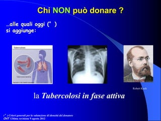 Chi NON può donare ?
…alle quali oggi (°)
si aggiunge:
(°) Criteri generali per la valutazione di idoneità del donatore
CNT Ultima revisione 9 agosto 2012
la Tubercolosi in fase attiva
Robert Koch
 