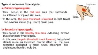 Comprehensive Overview of Pain Sensation, Types, and Control Mechanisms ...