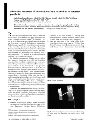 Minimizing movement of an orbital prosthesis retained by an obturator
    prosthesis
          Karin Wieselmann-Penkner, MD, DDS, PhD,a Gerwin Arnetzl, MD, DDS, PhD,b Wolfgang
          Mayer,c and Rudolph Bratschko, MD, DDS, PhDd
          Faculty of Dentistry, University of Graz, Graz, Austria
          This article describes a procedure in which an obturator with an integrated spring-loaded rewinding
          device retains an orbital prosthesis. This system minimizes movement of the orbital prosthesis during
          mastication and thus prevents adhesive failure. (J Prosthet Dent 2004;91:188-90.)




R      adical maxillectomy frequently leads to extended
defects in hard and soft tissues that result in a connection
                                                                  Germany) in the usual manner.3,7 Clinically verify
                                                                  the accuracy of ﬁt after the prosthesis has been worn
between the oral and nasal cavities.1-3 If the defect can-        for a few days, and make necessary corrections.
not be surgically reconstructed, an obturator prosthesis       2. Make an impression of the entire orbital defect
may be necessary to remedy dysfunction in mastication,            with silicone impression material (Epiform-Flex;
deglutition, and speech. For minor defects, enlargement           Dreve-Dentamid GmbH, Unna, Germany). Pour
of the base of the prosthesis is generally sufﬁcient.1,2          hard dental stone (Suprastone; Kerr GmbH,
Resections that affect more than one third of the maxilla
usually require an effective extension into the defect to
provide support and stability since the remaining alveo-
lus is insufﬁcient.1,2 A 1-piece or sectional obturator
prosthesis can serve these needs well.
    The situation becomes more difﬁcult, however, when
there is an open connection to the orbit and the patient
needs an orbital prosthesis in addition to the obturator.
If the orbital prosthesis cannot be retained by osseointe-
grated implants, it may be fastened to the spectacle
frame or ﬁxed with adhesive systems.4,5 With few or
missing undercuts, however, mimic motion and sneez-
ing can cause adhesive failure.6 Thus, the orbital pros-
thesis may be attached to the obturator with magnets or
buttons. Due to the missing orbital bone and the ex-
tended area of attachment between the obturator and
orbital prosthesis, however, the obturator may lose ver-
tical support and stability, and the attached orbital pros-    Fig. 1. Orbital prosthesis.
thesis may move during mastication, resulting in failure
of the adhesive and compromising the marginal integrity
of the prosthesis.6
    This article describes a procedure in which an obtu-
rator with an integrated spring-loaded rewinding device
retains an orbital prosthesis. This system minimizes
movement of the orbital prosthesis during mastication
and thus prevents adhesive failure.

TECHNIQUE
1. Fabricate a lightweight, closed, hollow obturator
   partial denture prosthesis from heat-processed acrylic
   resin (Palaxpress; Heraeus Kulzer, Wehrheim,

a
  Assistant Professor, Department of Prosthodontics.
b
  Assistant Professor, Department of Prosthodontics.           Fig. 2. Inner case with groove in circumference of outer edge
c
  Anaplastologist.                                             for nylon string and outer case with hole in rim for nylon
d
  Professor and Chairman, Department of Prosthodontics.        string.

188 THE JOURNAL OF PROSTHETIC DENTISTRY                                                              VOLUME 91 NUMBER 2
 