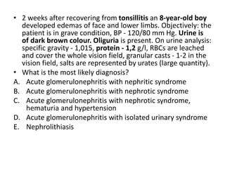 • 2 weeks after recovering from tonsillitis an 8-year-old boy
developed edemas of face and lower limbs. Objectively: the
patient is in grave condition, BP - 120/80 mm Hg. Urine is
of dark brown colour. Oliguria is present. On urine analysis:
specific gravity - 1,015, protein - 1,2 g/l, RBCs are leached
and cover the whole vision field, granular casts - 1-2 in the
vision field, salts are represented by urates (large quantity).
• What is the most likely diagnosis?
A. Acute glomerulonephritis with nephritic syndrome
B. Acute glomerulonephritis with nephrotic syndrome
C. Acute glomerulonephritis with nephrotic syndrome,
hematuria and hypertension
D. Acute glomerulonephritis with isolated urinary syndrome
E. Nephrolithiasis
 