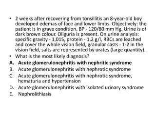 • 2 weeks after recovering from tonsillitis an 8-year-old boy
developed edemas of face and lower limbs. Objectively: the
patient is in grave condition, BP - 120/80 mm Hg. Urine is of
dark brown colour. Oliguria is present. On urine analysis:
specific gravity - 1,015, protein - 1,2 g/l, RBCs are leached
and cover the whole vision field, granular casts - 1-2 in the
vision field, salts are represented by urates (large quantity).
• What is the most likely diagnosis?
A. Acute glomerulonephritis with nephritic syndrome
B. Acute glomerulonephritis with nephrotic syndrome
C. Acute glomerulonephritis with nephrotic syndrome,
hematuria and hypertension
D. Acute glomerulonephritis with isolated urinary syndrome
E. Nephrolithiasis
 