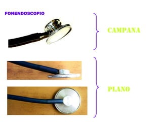 FONENDOSCOPIO
CAMPANA
PLANO
 