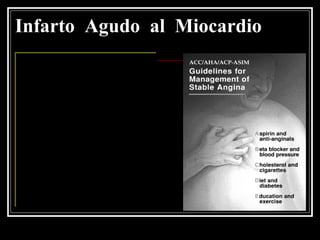 Infarto Agudo al Miocardio
 