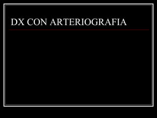 DX CON ARTERIOGRAFIA
 