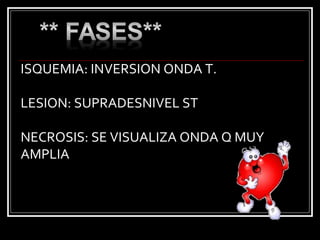 ISQUEMIA: INVERSION ONDA T.
LESION: SUPRADESNIVEL ST
NECROSIS: SE VISUALIZA ONDA Q MUY
AMPLIA
 