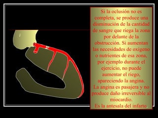 Si la oclusión no es
completa, se produce una
disminución de la cantidad
de sangre que riega la zona
por delante de la
obstrucción. Si aumentan
las necesidades de oxigeno
o nutrientes de esa zona,
por ejemplo durante el
ejercicio, no puede
aumentar el riego,
apareciendo la angina.
La angina es pasajera y no
produce daño irreversible al
miocardio.
Es la antesala del infarto.
 