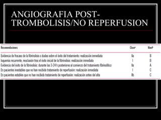 ANGIOGRAFIA POST-
TROMBOLISIS/NO REPERFUSION
 