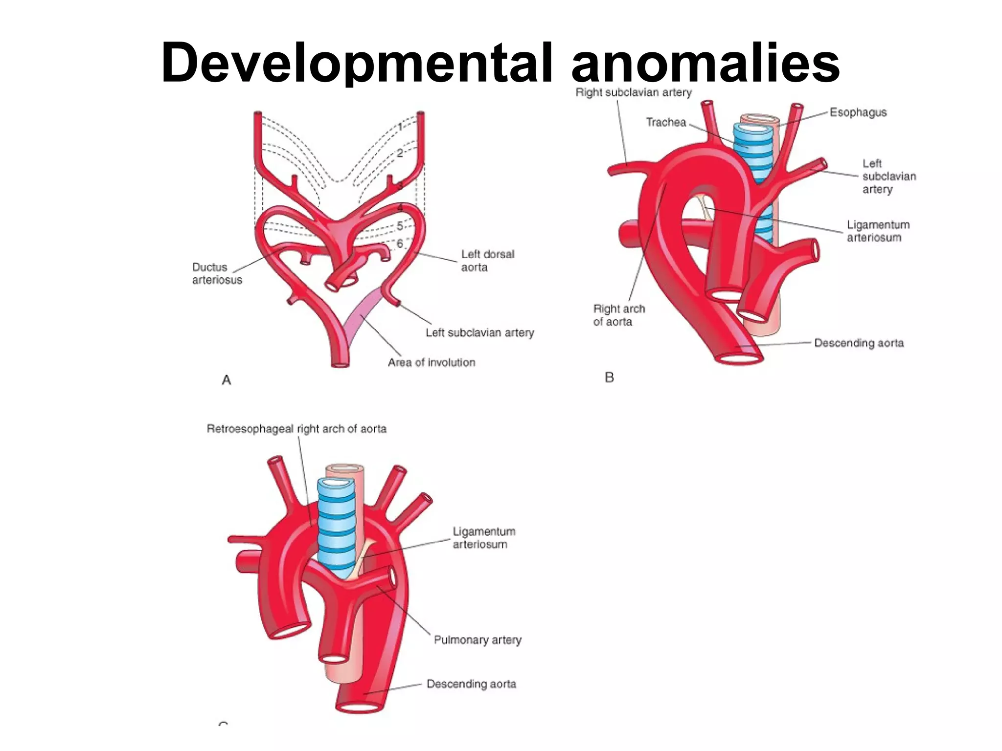 Developmental anomalies
 