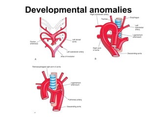 Developmental anomalies
 