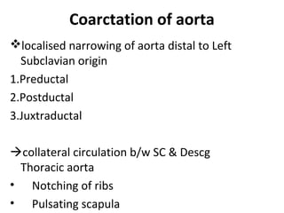Coarctation of aorta
localised narrowing of aorta distal to Left
Subclavian origin
1.Preductal
2.Postductal
3.Juxtraductal
collateral circulation b/w SC & Descg
Thoracic aorta
• Notching of ribs
• Pulsating scapula
 