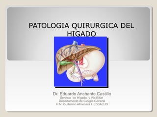 PATOLOGIA QUIRURGICA DEL
HIGADO

Dr. Eduardo Anchante Castillo
Servicio de Hígado y Vía Biliar
Departamento de Cirugía General
H.N. Guillermo Almenara I. ESSALUD

 