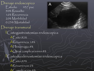 Drenaje endoscopico
Estudio
437 pac
90% Resuelto
16% Recurrencia
20% Morbilidad
0.23% Mortalidad

Drenaje transmural
Cistogastrostomías endoscopica
Éxito 82%

Recurrencia 18%
Hemorragia 8%

Otras complicaciones 8%

Cistoduodenostomías endoscopica
Éxito 89%

Recurrencia 6%


 