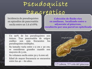 Pseudoquiste
Pancreatico

Incidencia de pseudoquistes
en episodios de pancreatitis
oscila entre un 1.6 al 69%








Colección de fluido rico
Colección de fluido rico
en amilasas, localizado entre o
en amilasas, localizado entre o
adyacente al páncreas,
adyacente al páncreas,
recubierto por una pared no epitelizada
recubierto por una pared no epitelizada

Un 90% de los pseudoquistes son
únicos. Tras pancreatitis de origen
enólico son más frecuentes los
pseudoquistes múltiples.
Su tamaño varía entre 1-2 cm y 30 cm;
se consideran grandes cuando son
mayores de 5 cm.
Su volumen oscila entre 50 y 6.000 ml.
Edad de mayor frecuencia se encuentra
entre los 40 – 60 años.

1/3 cabeza, 2/3 cola del páncreas
1/3 cabeza, 2/3 cola del páncreas

 