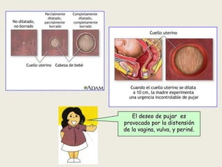 El deseo de pujar es
provocado por la distensión
de la vagina, vulva, y periné.

 
