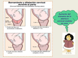 Aumento del
diámetro de la
abertura
cervical medida
en cms.

 