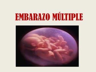 EMBARAZO MÚLTIPLE

 