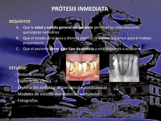 PRÓTESIS INMEDIATA
REQUISITOS
A. Que la edad y estado general del paciente permitan las intervenciones
quirúrgicas necesarias
B. Que el estado de la boca y dientes admitan la espera requerida para el trabajo
preparatorio
C. Que el paciente desee este tipo de servicio y esté dispuesto a aceptarlo

ESTUDIO
- Historia clínica
- Exploración clínica
- Exploración radiológica (periapical + panorámica)
- Modelos de estudio montados en articulador
- Fotografías

 
