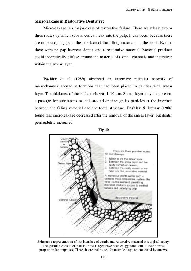 microleakage in restorative dentistry/rotary endodontic courses by in…