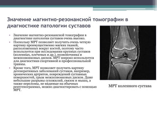 Значение магнитно-резонансной томографии в 
диагностике патологии суставов 
• Значение магнитно-резонансной томографии в 
диагностике патологии суставов очень высоко. 
• Поскольку МРТ позволяет получить очень четкую 
картину преимущественно мягких тканей, 
расположенных вокруг костей, поэтому часто 
используется при исследовании крупных суставов 
(коленных, плечевых и др.), позвоночника и 
межпозвонковых дисков. МРТ широко используется 
для диагностики спортивной и профессиональной 
травмы. 
• Кроме того, МРТ позволяет получить картину 
дегенеративных заболеваний суставов, например, 
хронических артритов, повреждений суставных 
поверхностей, грыж межпозвонковых дисков. Даже 
небольшие разрывы сухожилий, связок и мышц, а 
также переломы, не видимые на обычных 
рентгенограммах, можно диагностировать с помощью 
МРТ. 
МРТ коленного сустава 
 