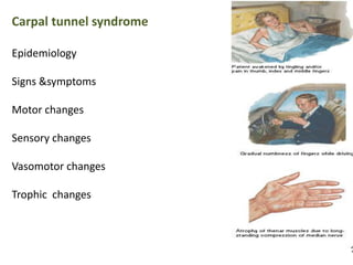 Carpal tunnel syndrome 
Epidemiology 
Signs &symptoms 
Motor changes 
Sensory changes 
Vasomotor changes 
Trophic changes 
 