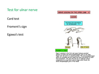 Test for ulnar nerve 
Card test 
Froment’s sign 
Egawa’s test 
 