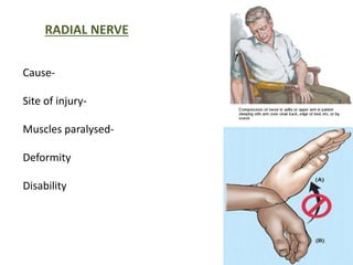RADIAL NERVE 
Cause- 
Site of injury- 
Muscles paralysed- 
Deformity 
Disability 
 