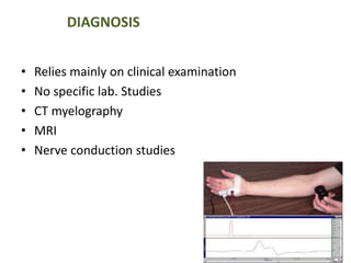 DIAGNOSIS 
• Relies mainly on clinical examination 
• No specific lab. Studies 
• CT myelography 
• MRI 
• Nerve conduction studies 
 