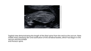Early pregnancy scanning at 11-14 w scan.pptx