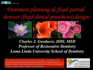 Charles J. Goodacre, DDS, MSD
Professor of Restorative Dentistry
Loma Linda University School of Dentistry
This program of instruction is protected by copyright ©. No portion of this
program of instruction may be reproduced, recorded or transferred by any
means electronic, digital, photographic, mechanical etc., or by any information
storage or retrieval system, without prior permission.
Treatment planning & fixed partial
denture (fixed dental prostheses) designs
 