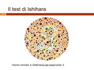 Il test di Ishihara
Visione normale: 5; Daltonismo per rosso/verde: 2R.Polillo - Marzo 2015
9
 