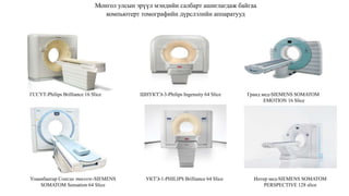 Монгол улсын эрүүл мэндийн салбарт ашиглагдаж байгаа
компьютерт томографийн дүрслэлийн аппаратууд
ГССҮТ-Philips Brilliance 16 Slice ШНУКТЭ-3-Philips Ingenuity 64 Slice Гранд мед-SIEMENS SOMATOM
EMOTION 16 Slice
Улаанбаатар Сонгдо эмнэлэг-SIEMENS
SOMATOM Sensation 64 Slice
УКТЭ-1-PHILIPS Brilliance 64 Slice Интер мед-SIEMENS SOMATOM
PERSPECTIVE 128 slice
 