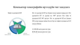 Компьютер томографийн ирэээдүйн чиг хандлага
Нэг эх үүсвэртэй КТ-ыг бодвол илүү хурдан илрүүлдэг. Нэг
үүсвэртэй КТ эх үүсвэр нь 1800 эргэдэг бол хоёр эх
үүсвэртэй КТ 900 эргэдэг. Нэг эх үүсвэртэй КТ-ыг бодвол
50% илүү хурдан хайдаг ба нэг бүтэн тойрох хугацаа нь 0.25
секунд байдаг.
А-140 kВ хатуу рентген туяа
В-80 кВ зөөлөн рентген туяа
Хоёр эх үүсвэртэй КТ
 